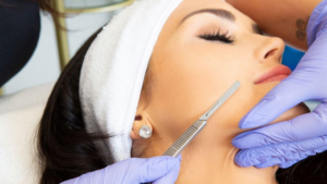 Dermaplaning: A Comprehensive Guide for Aesthetics Professionals