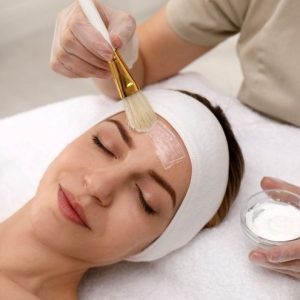 What Are 2nd Generation Peels?